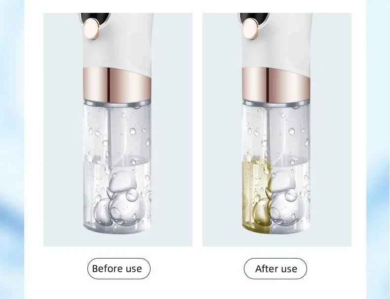 Super Micro Bubble Facial Cleansing Device & Blackhead Remover