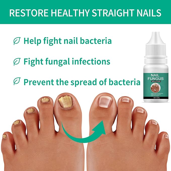 Nexusdrop Nail Treatement Solution