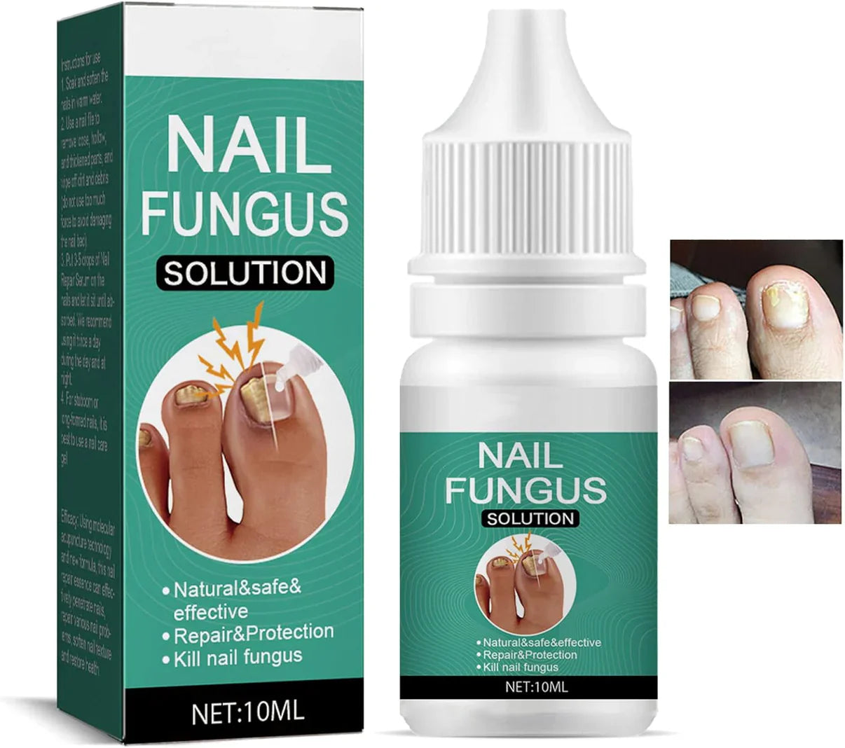 Nexusdrop Nail Treatement Solution