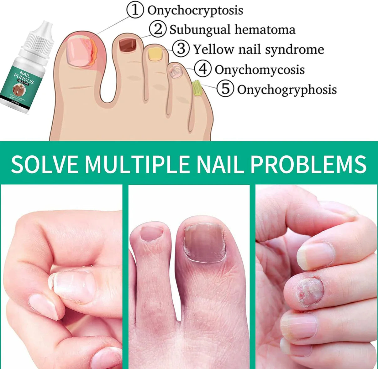 Nexusdrop Nail Treatement Solution