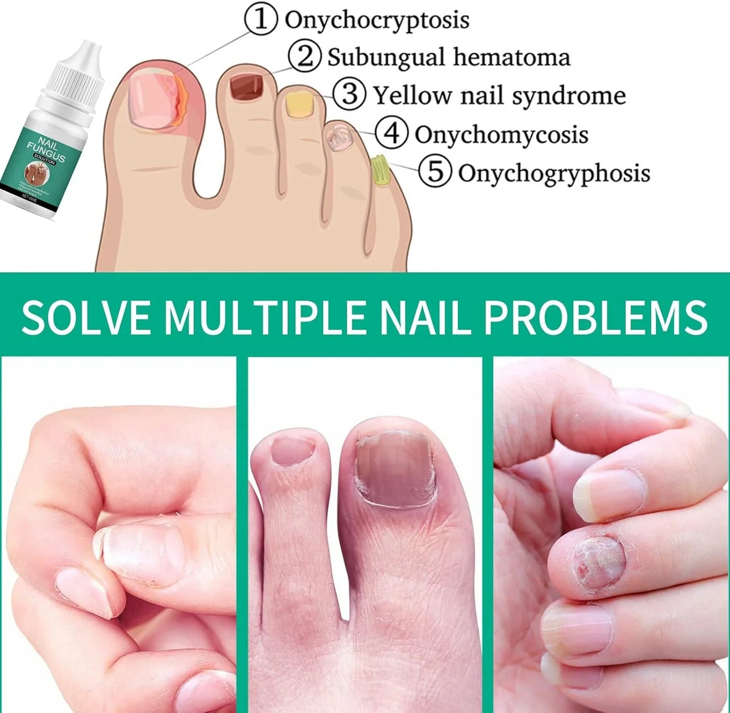 Nexusdrop Nail Treatement Solution