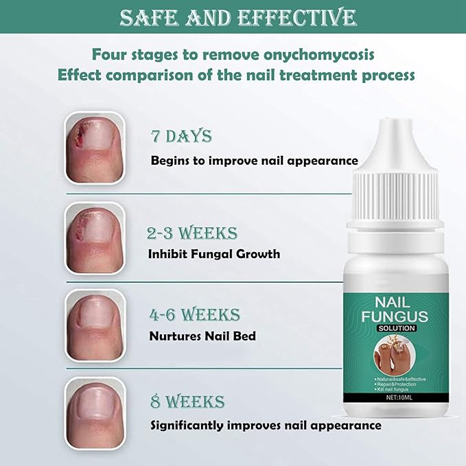 Nexusdrop Nail Treatement Solution