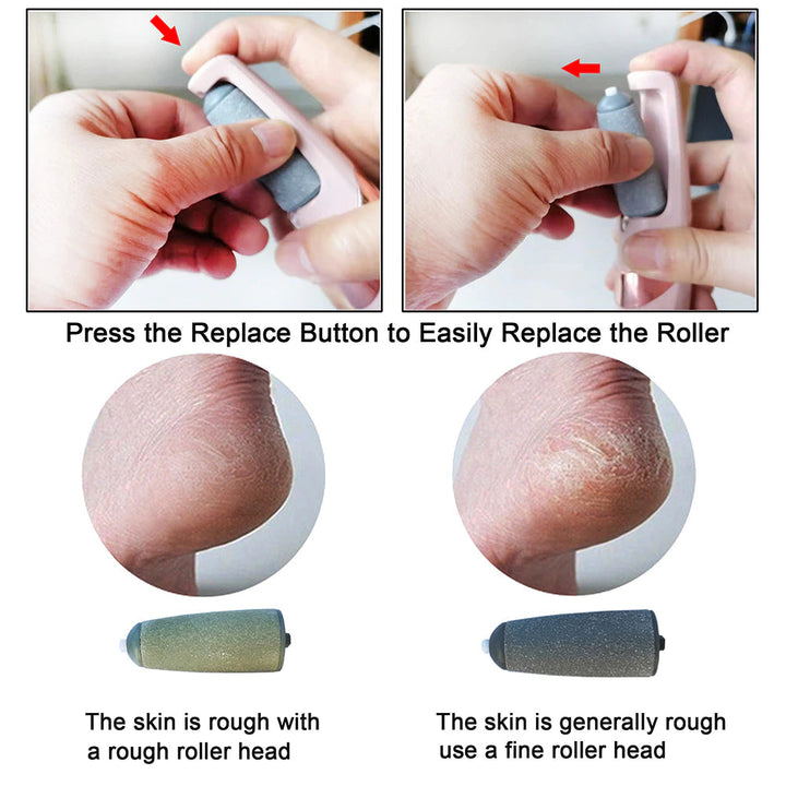 Electric Callus Remover